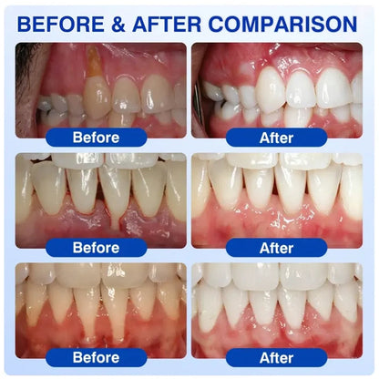 GumRevive Periodontal Care Gel