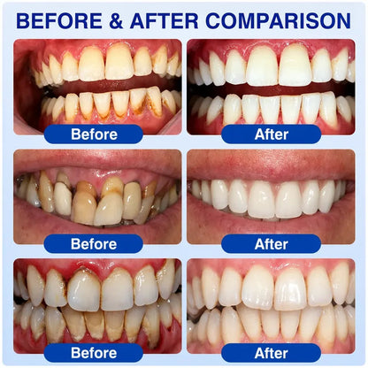 GumRevive Periodontal Care Gel