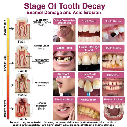 DenPerm Cavity-Repair Natural Enamel Filling Gel