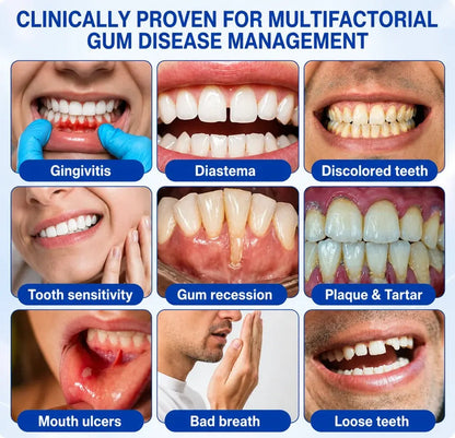 GumRevive Periodontal Care Gel