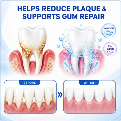 GumRevive Periodontal Care Gel